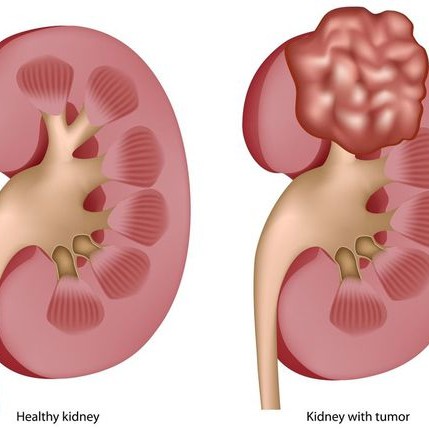 Саранск порно
