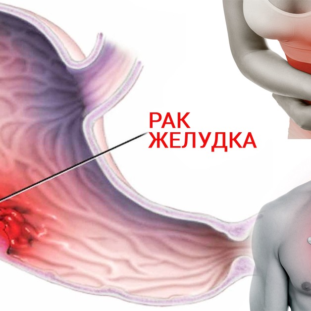 Олар киска арқылы асқазанды ауамен толтырады